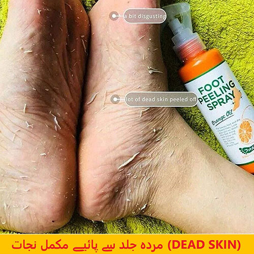 Foot Peeling Spray with Orange Oil Essence for Dead Skin Exfoliation
