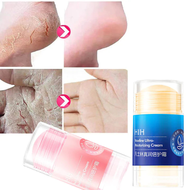 Vaseline Moisturizing Anti Crack-Drying Hand & Foot STICK